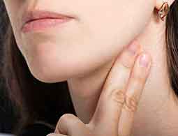 片頭痛の対処法